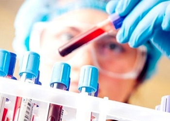 CRP nedir? Neden yükselir, hangi hastalıkların belirtisidir?