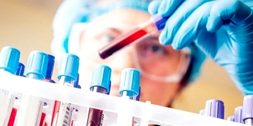 CRP nedir? Neden yükselir, hangi hastalıkların belirtisidir?