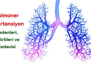 Pulmoner hipertansiyon nedir? Nedenleri, belirtileri ve tedavisi