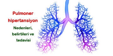 Pulmoner hipertansiyon nedir? Nedenleri, belirtileri ve tedavisi