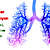 Pulmoner hipertansiyon nedir? Nedenleri, belirtileri ve tedavisi