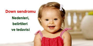 Down sendromu nedir, neden olur? Belirtileri ve tedavisi