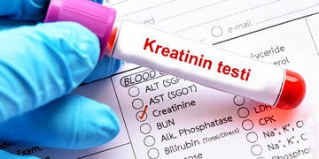 Kreatinin nedir, neye yarar? Yüksekliği ve düşüklüğü neye yol açar?