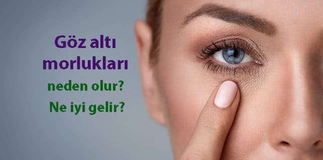 Yetiskin Gelistirmek Tufek Mor Halkalar Icin Goz Blog Samsunozon Com