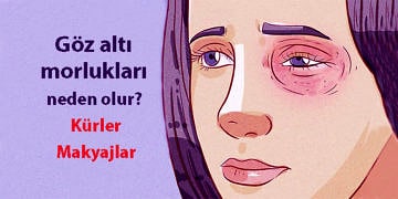 Göz altı morlukları neden olur? Göz morluğuna ne iyi gelir?