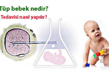 Tüp bebek nedir? Tedavisi nasıl yapılır? Aşamaları ve fiyatı