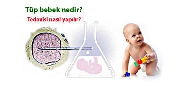 Tüp bebek nedir? Tedavisi nasıl yapılır? Aşamaları ve fiyatı