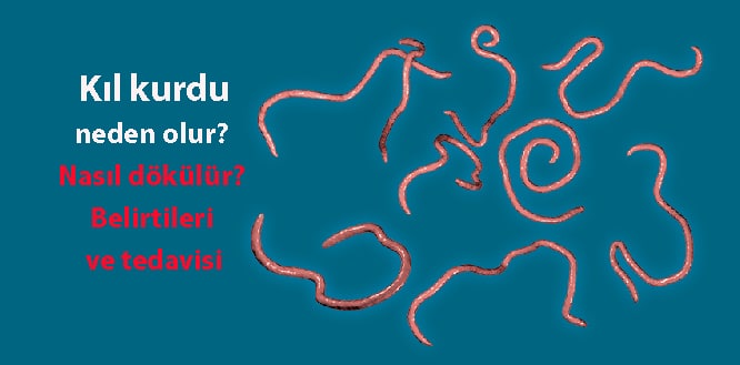 kil kurdu nedir neden olur nasil dokulur belirtileri ve tedavisi