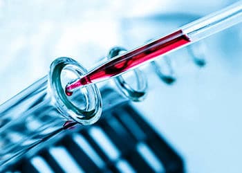 Erken menopoz döneminde PRP yöntemi uygulanabilir mi?