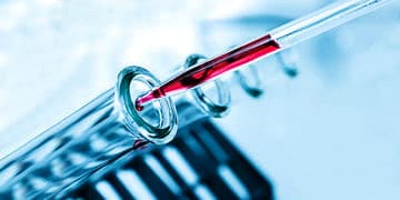 Erken menopoz döneminde PRP yöntemi uygulanabilir mi?