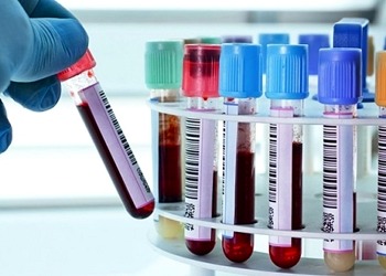 Sağlıklı bir ömür geçirmek istiyorsanız bu tarama testleri yaptırmalısınız