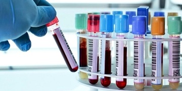 Sağlıklı bir ömür geçirmek istiyorsanız bu tarama testleri yaptırmalısınız