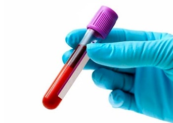 Antikor nedir, ne işe yarar? Testi, bağışıklık ve koronavirüs tedavisine etkisi