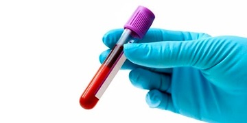 Antikor nedir, ne işe yarar? Testi, bağışıklık ve koronavirüs tedavisine etkisi