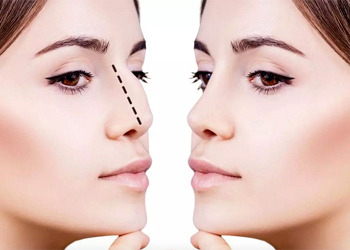 Estetik operasyonlar sonrası iyileşme süreci nasıldır?