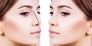 Estetik operasyonlar sonrası iyileşme süreci nasıldır?