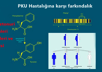 Her 100 kişiden 4’ünde görülen PKU hastalığına karşı farkındalık çok önemli