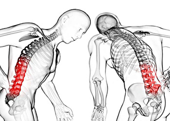 Bel ağrısı neden olur? Belirtileri, tedavisi ve egzersiz yöntemleri