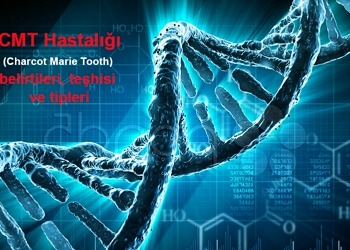 Genetik Hastalıklar: Charcot Marie Tooth (CMT); belirtileri, tipleri ve tedavisi