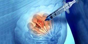 Biyopsi nedir, nasıl yapılır? Biyopsinin riski var mıdır?