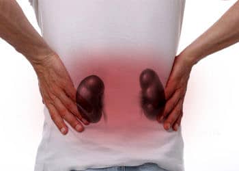 Böbrek ağrısı nedir? Belirtileri nelerdir? Tedavisi nasıl yapılır?