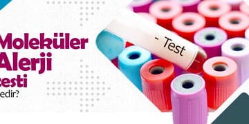 Madx Mat Moleküler Alerji Testi Nedir?
