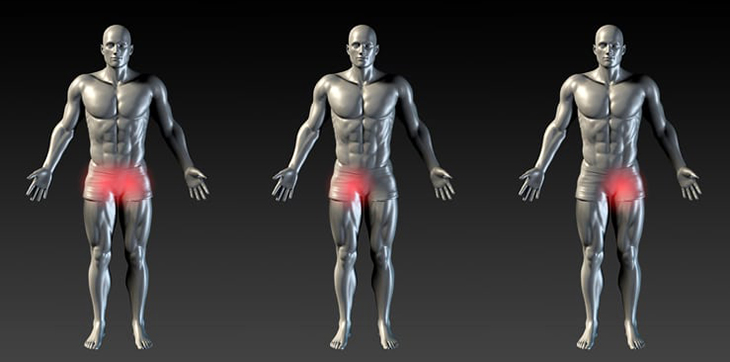 Kasık ağrısı neden olur? Nasıl geçer? Kasık ağrısına ne iyi gelir?