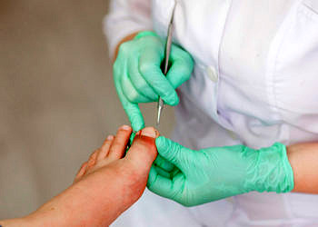 Tırnak batması neden olur, ne iyi gelir? Belirtileri ve tedavisi