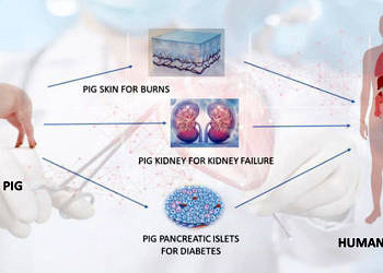 Domuzdan insana organ nakli; Xenotransplantation nasıl bir gelecek vaadediyor?