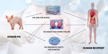 Domuzdan insana organ nakli; Xenotransplantation nasıl bir gelecek vaadediyor?