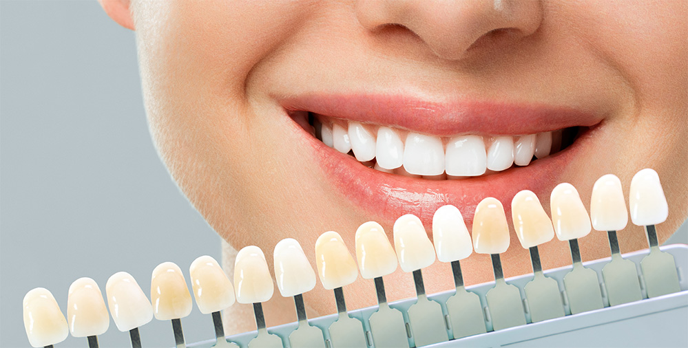 Zirkonyum diş kaplama nedir? Nasıl yapılır? Avantajları ve fiyatı