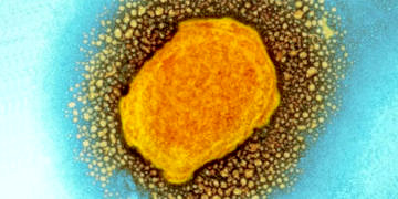 Türk Tabipleri Birliği maymun çiçeği hastalığı için koruma ve aşı programı önerdi