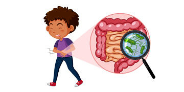 Salmonella nedir? Nasıl bulaşır? Belirtileri ve tedavisi