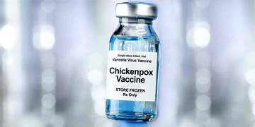 Suçiçeği aşısı nedir? Ne zaman yapılmalı? Yan etkileri nelerdir?