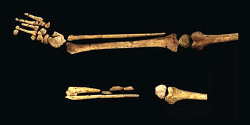 30 bin yıl önce yapılmış en eski ampütasyona dair kanıtlar bulundu