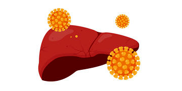 Hepatit A nasıl bulaşır? Belirtileri nelerdir? Aşısı ve tedavisi