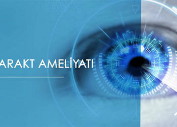 Katarakt Ameliyatı Hakkında Bilinmesi Gerekenler