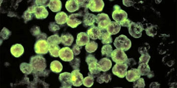 Beyin yiyen amip ABD’de bir kişinin ölümüne yol açtı