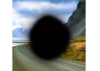 Sarı nokta hastalığı nedir? Belirtileri ve tedavisi