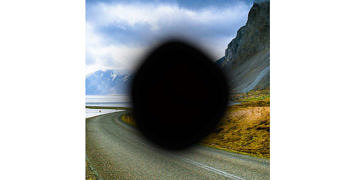 Sarı nokta hastalığı nedir? Belirtileri ve tedavisi