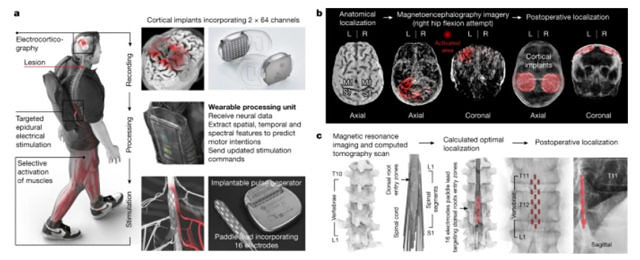 BSI'nın tasarımı, teknolojisi ve yerleştirilmesi.