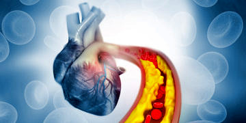 Kolesterolü yükselten nedenler ve düşürme yolları