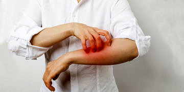 Doç. Dr. Yürekli: Uyuz hastalığının görülme sıklığı pandemi sonrasında % 50 arttı