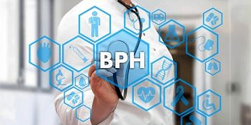 İyi Huylu Prostat Büyümesinin (BPH) Uzun Vadeli Etkileri: Ne Beklemelisiniz?