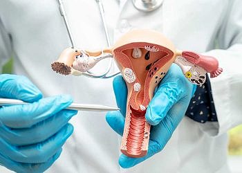 Yumurtalık Kanseri Nedir? Yumurtalık Kanseri Belirtileri