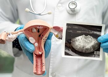 Prostat Kanseri Nedir? Prostat Kanseri Belirtileri Nelerdir?