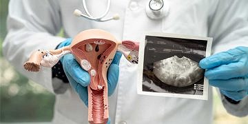 Prostat Kanseri Nedir? Prostat Kanseri Belirtileri Nelerdir?