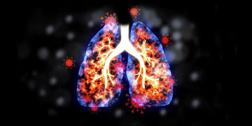 Yeni Çalışma: Akciğer Hastalıkları Sonrası Gelişen Mantar Enfeksiyonu Ölümcül Olabilir
