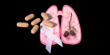 Kullanıma Giren 3 Yeni İlaç ile Dirençli Verem Tedavisinde Başarı %90’a Ulaştı