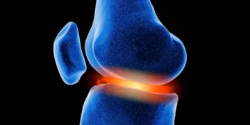 Menisküs Yırtığı Tedavisi: Cerrahi ve Ameliyatsız Güncel Yaklaşımlar